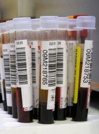 בדיקת דם